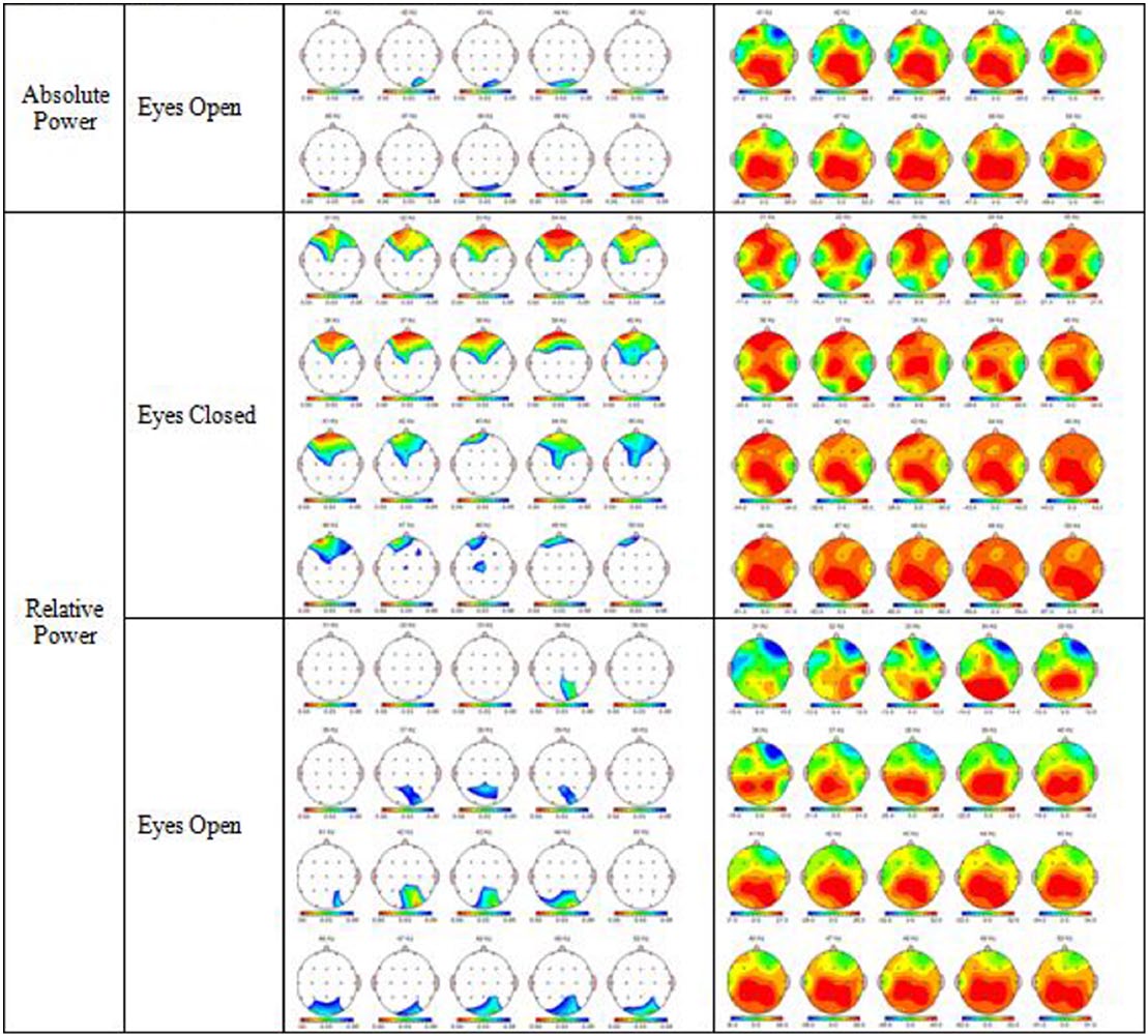 Figure 5: original published qEEG comparisons across selected frequencies
